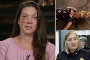 Single mom battered by Cincinnati mob slams ‘insulting’ police chief for calling the beatdown an ‘incident’ Single mom battered by Cincinnati mob slams ‘insulting’ police chief for calling the beatdown an ‘incident’