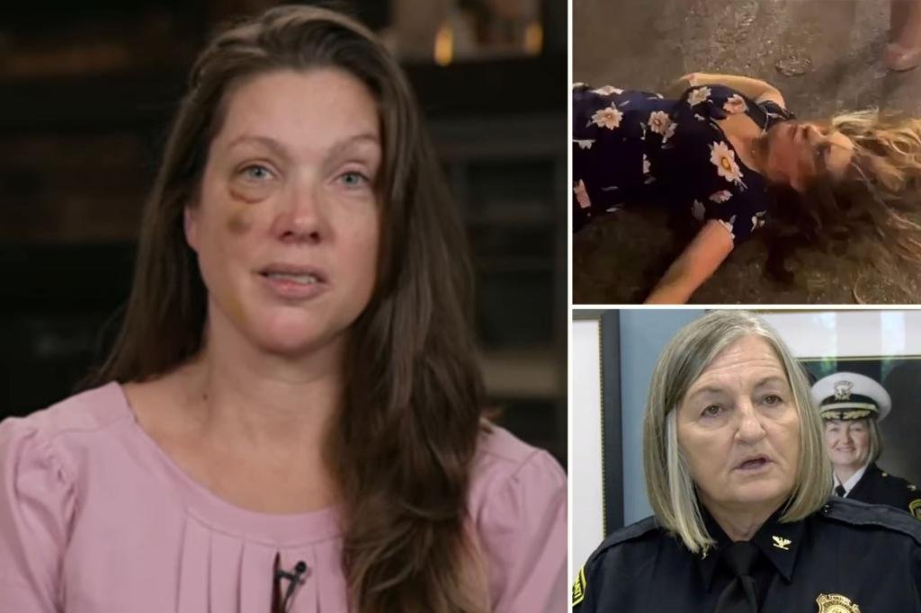 Single mom battered by Cincinnati mob slams ‘insulting’ police chief for calling the beatdown an ‘incident’ Single mom battered by Cincinnati mob slams ‘insulting’ police chief for calling the beatdown an ‘incident’