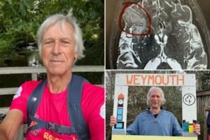 Man diagnosed with ear infection later learns it was a sign of a rare brain tumor Man diagnosed with ear infection later learns it was a sign of a rare brain tumor