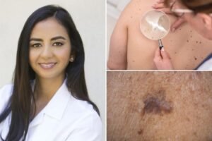 The ‘ABCDEs’ of skin cancer — 9 clues you shouldn’t ignore The ‘ABCDEs’ of skin cancer — 9 clues you shouldn’t ignore