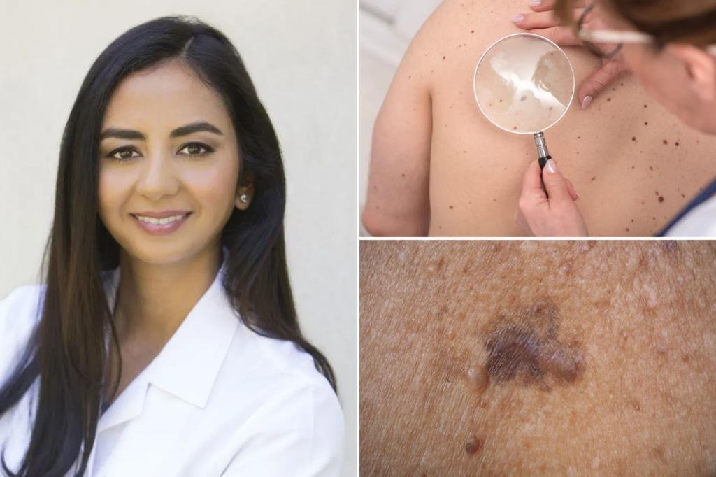 The ‘ABCDEs’ of skin cancer — 9 clues you shouldn’t ignore The ‘ABCDEs’ of skin cancer — 9 clues you shouldn’t ignore