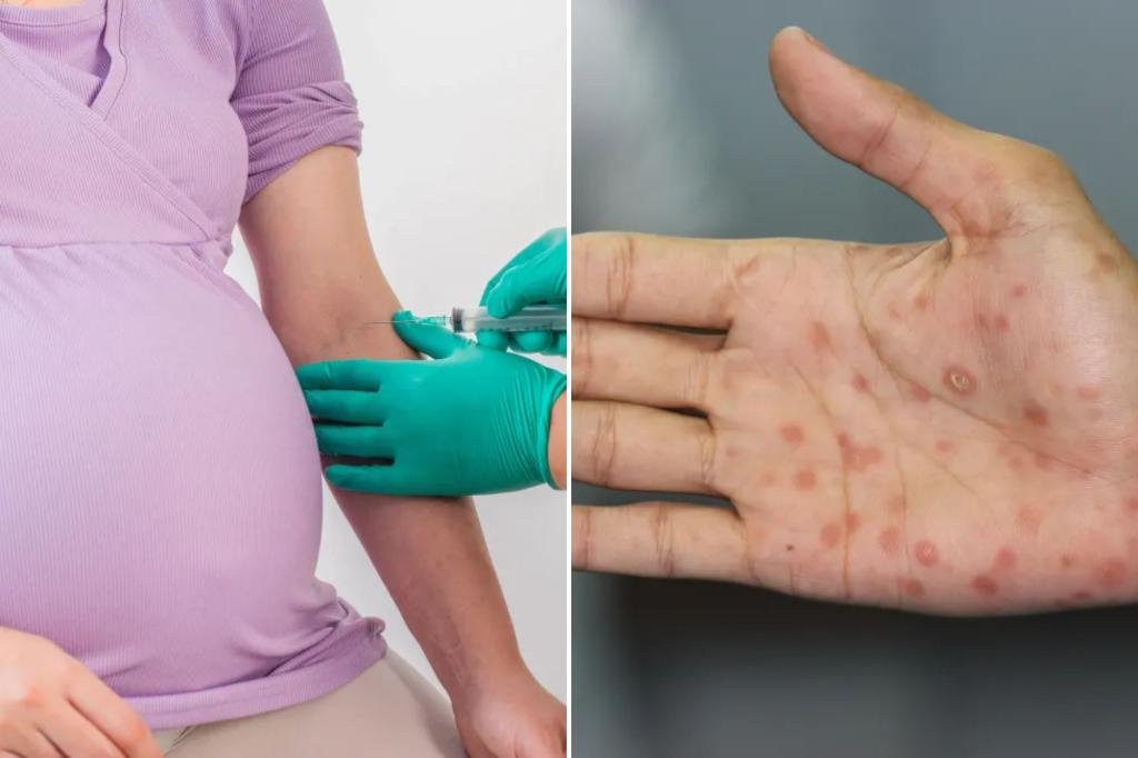 Three babies die amid ‘concerning rise’ of syphilis in New York — what to know about the dangerous disease Three babies die amid ‘concerning rise’ of syphilis in New York — what to know about the dangerous disease