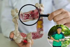 This health nut habit may actually increase your colorectal cancer odds: ‘You never hear it’s bad for you’ This health nut habit may actually increase your colorectal cancer odds: ‘You never hear it’s bad for you’