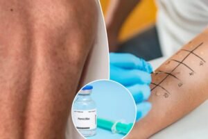 Lots of Americans think they have this allergy — but only 1% really do Lots of Americans think they have this allergy — but only 1% really do