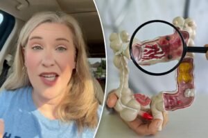 I had stage 4 colon cancer at 32 — the symptoms I missed, I chalked it up to just having a baby I had stage 4 colon cancer at 32 — the symptoms I missed, I chalked it up to just having a baby