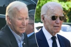 What is Mohs surgery? All about the procedure to remove President Joe Biden’s new cancer What is Mohs surgery? All about the procedure to remove President Joe Biden’s new cancer