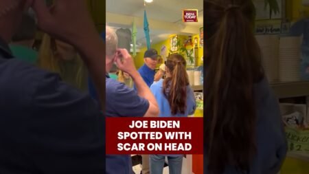 Ex-US President Joe Biden Spotted With Visible Scar On His Head After Surgery