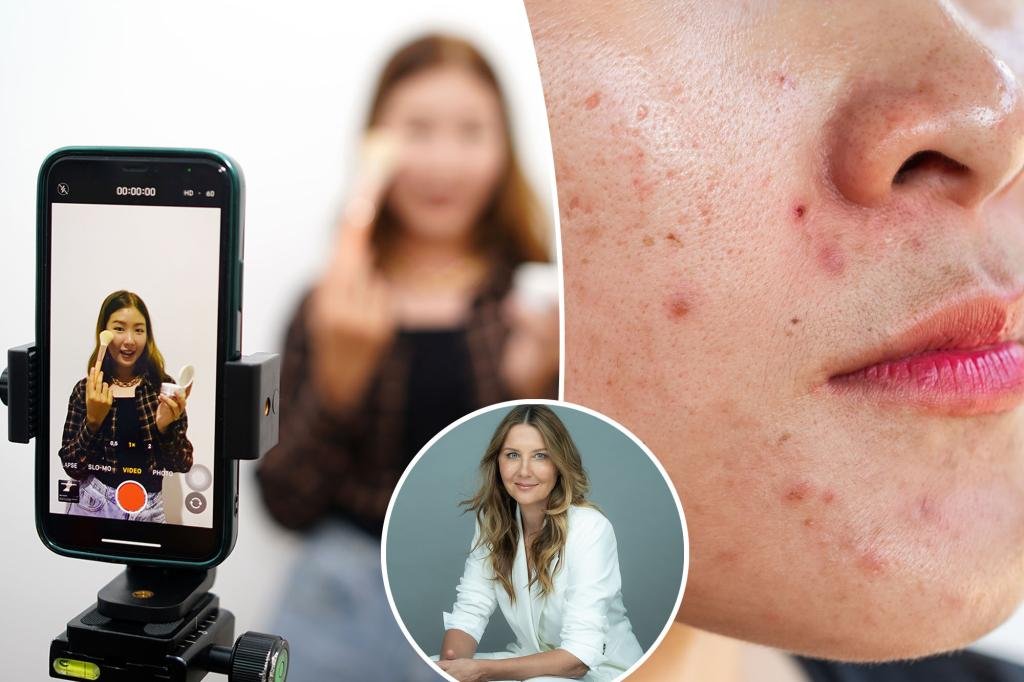 Beware the ‘glow trap’: Dermatologist warns TikTok is driving the rise of painful ‘influencer inflammation’ Beware the ‘glow trap’: Dermatologist warns TikTok is driving the rise of painful ‘influencer inflammation’