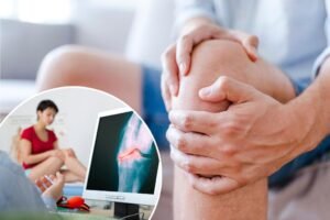 Knee damage increasingly found in young adults, with expert revealing two key reasons Knee damage increasingly found in young adults, with expert revealing two key reasons