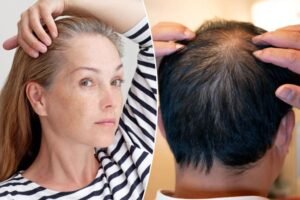These 2 drinks can make you go gray and bald — plus the nutrient that 5 studies say can help These 2 drinks can make you go gray and bald — plus the nutrient that 5 studies say can help