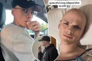 Seemingly ‘healthy’ young man suffers collapsed lung after nearly a decade of vaping: ‘Wake-up call’ Seemingly ‘healthy’ young man suffers collapsed lung after nearly a decade of vaping: ‘Wake-up call’