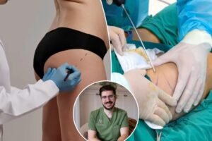 I’m a plastic surgeon — why I’d never perform an ‘awake BBL,’ I’ve heard absolute horror stories I’m a plastic surgeon — why I’d never perform an ‘awake BBL,’ I’ve heard absolute horror stories