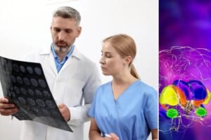 Hope for sufferers of devastating brain disease as new treatment has 75% success rate Hope for sufferers of devastating brain disease as new treatment has 75% success rate