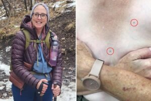 Cancer left me with tattoos I never asked for: This is how I reclaimed my body