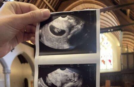 PA Bills Could Allow Public Funding Of Abortion Up To Birth