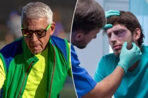 This huge fitness trend is sending people to the hospital at an ‘alarming rate’