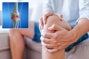 Experimental treatment eases knee arthritis pain without surgery or pills