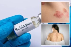 Shingles vaccine connected to significant health benefits, experts reveal Shingles vaccine connected to significant health benefits, experts reveal
