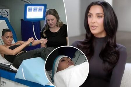 What does it mean that Kim Kardashian had a ‘little aneurysm’ — and is it deadly?