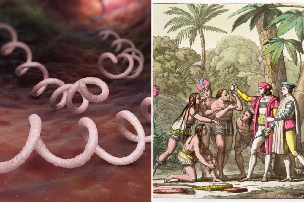Syphilis-linked bacteria was in the Americas long before Columbus’ arrival: study Syphilis-linked bacteria was in the Americas long before Columbus’ arrival: study