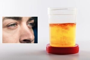 This common condition could hide an early cancer warning This common condition could hide an early cancer warning