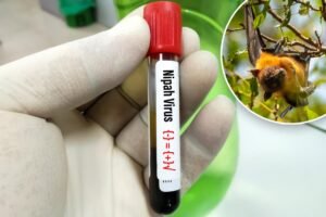 What is Nipah virus? Disease with ‘relatively high death rate’ found in India