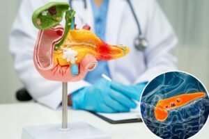 Pancreatic cancer researchers’ latest breakthrough could help tumors disappear