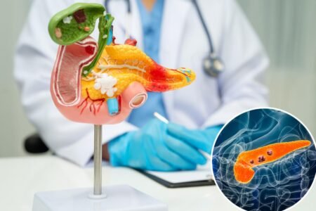 Pancreatic cancer researchers’ latest breakthrough could help tumors disappear